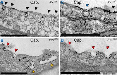 Endothelial Transcytosis in Acute Lung Injury: Emerging Mechanisms and Therapeutic Approaches